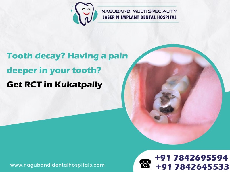 Tooth decay? Having a pain deeper in your tooth? Get RCT in Kukatpally