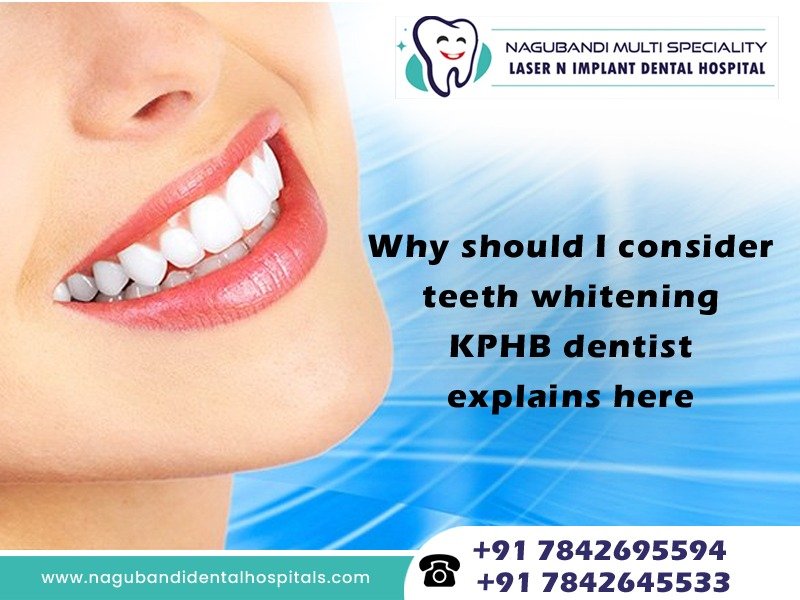 Why should I consider teeth whitening: KPHB dentist explains here