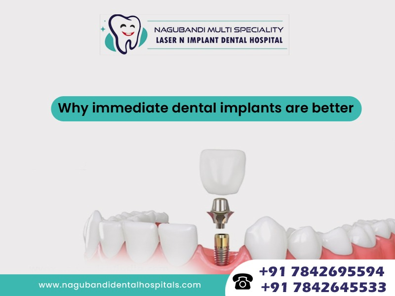 Why immediate dental implants are better?