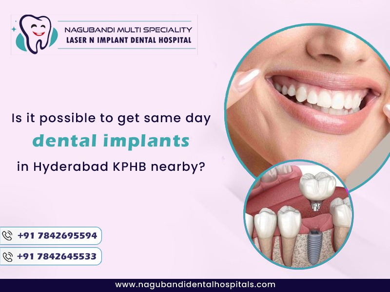 Is it possible to get same-day dental implants in Hyderabad KPHB nearby?