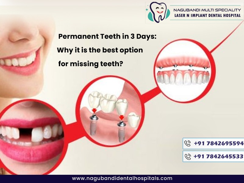 Permanent Teeth within a day to 3 Days: Why is it the best option for missing teeth? 