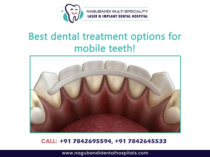 Best dental treatment options for mobile teeth!